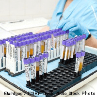 blood sample testing